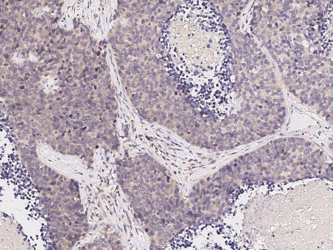 JNK2 Antibody in Immunohistochemistry (Paraffin) (IHC (P))