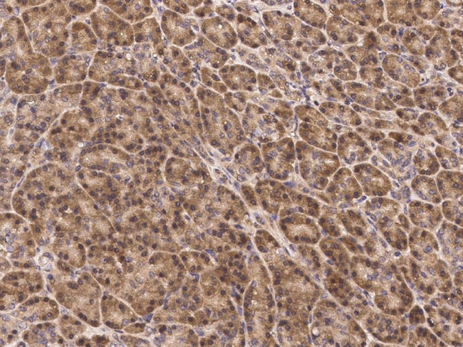 JNK2 Antibody in Immunohistochemistry (Paraffin) (IHC (P))