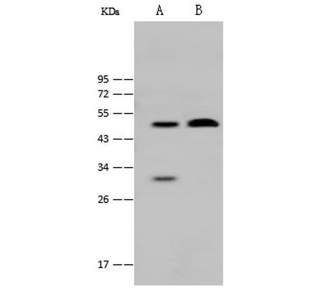 MBD2 Antibody in Western Blot (WB)