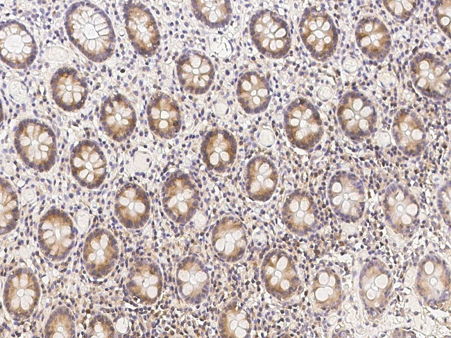 METAP2 Antibody in Immunohistochemistry (Paraffin) (IHC (P))