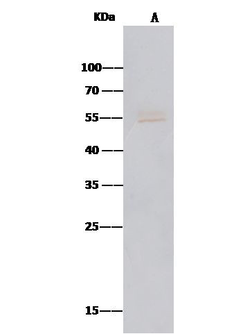 MICA Antibody in Immunoprecipitation (IP)