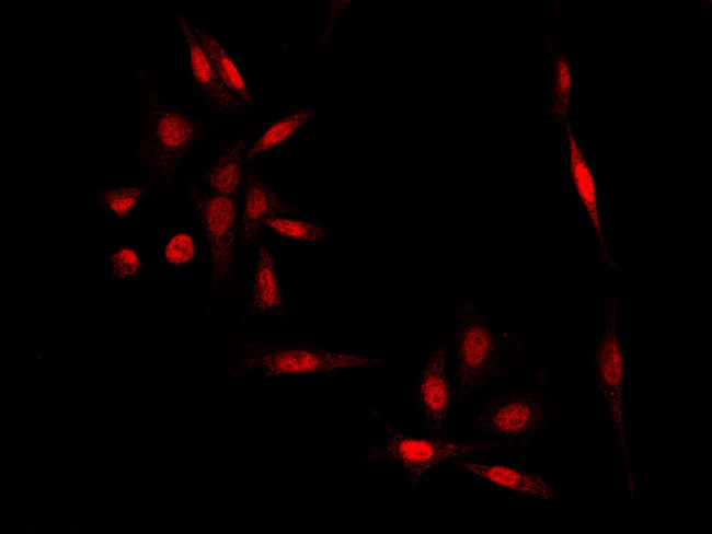 MMP12 Antibody in Immunocytochemistry (ICC/IF)