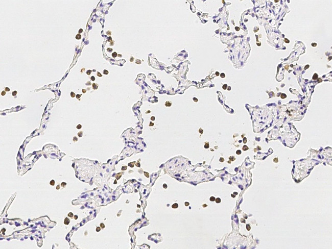 MMP12 Antibody in Immunohistochemistry (Paraffin) (IHC (P))