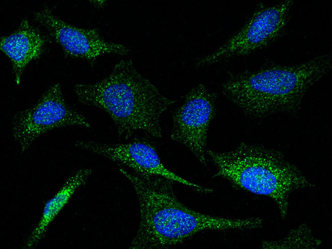 MMP13 Antibody in Immunocytochemistry (ICC/IF)