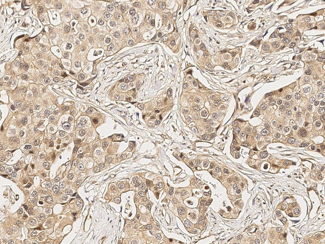 MMP13 Antibody in Immunohistochemistry (Paraffin) (IHC (P))