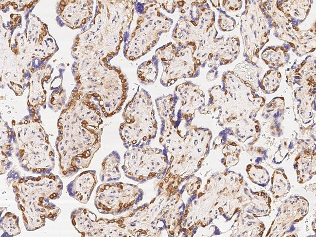 MSI2 Antibody in Immunohistochemistry (Paraffin) (IHC (P))