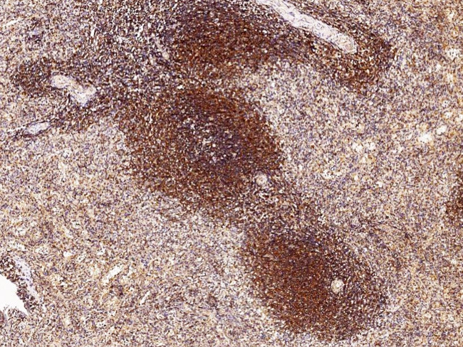 ARD1A Antibody in Immunohistochemistry (Paraffin) (IHC (P))