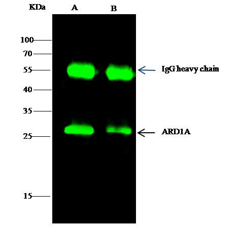 ARD1A Antibody in Immunoprecipitation (IP)