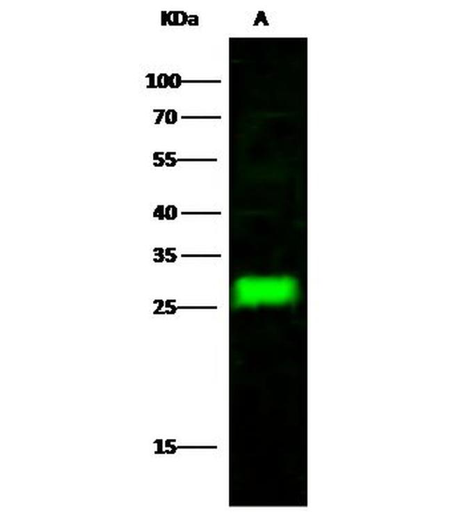 ARD1A Antibody in Western Blot (WB)