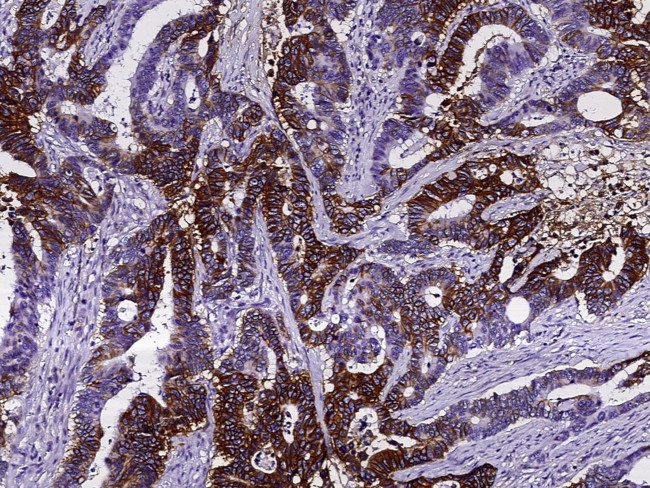 NDRG1 Antibody in Immunohistochemistry (Paraffin) (IHC (P))