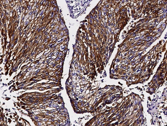 NDRG1 Antibody in Immunohistochemistry (Paraffin) (IHC (P))