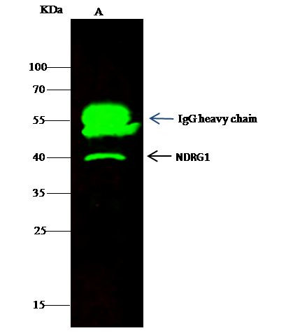 NDRG1 Antibody in Immunoprecipitation (IP)