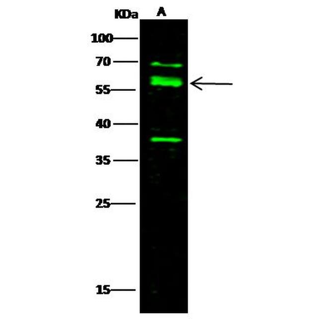 Nectin 3 Antibody in Western Blot (WB)