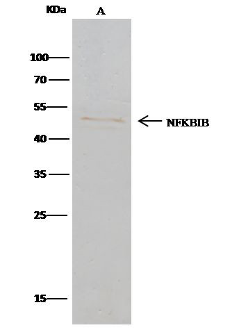 IkB beta Antibody in Immunoprecipitation (IP)