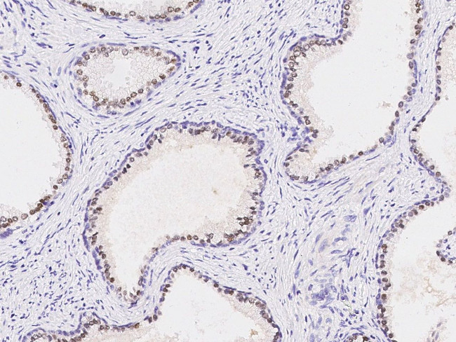 Nkx3.1 Antibody in Immunohistochemistry (Paraffin) (IHC (P))