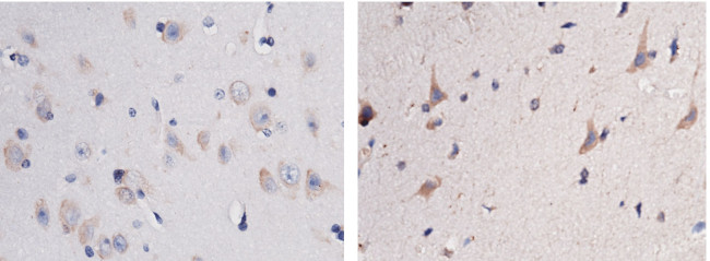 NOV Antibody in Immunohistochemistry (Paraffin) (IHC (P))