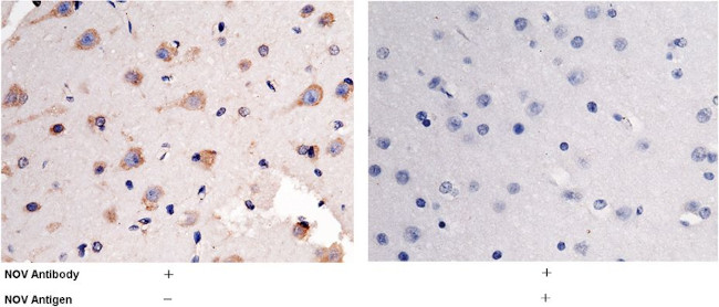 NOV Antibody in Immunohistochemistry (Paraffin) (IHC (P))