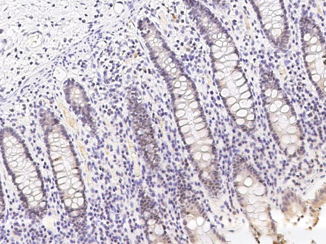 NR0B1 Antibody in Immunohistochemistry (Paraffin) (IHC (P))