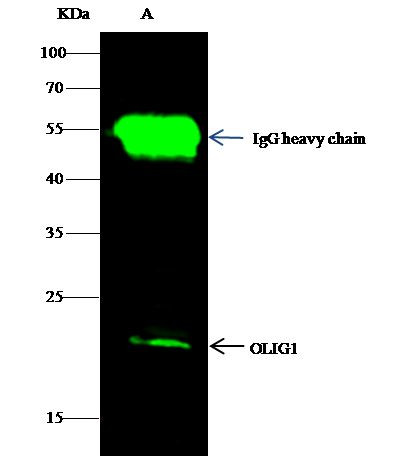 OLIG1 Antibody in Immunoprecipitation (IP)