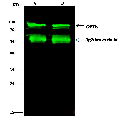 Optineurin Antibody in Immunoprecipitation (IP)