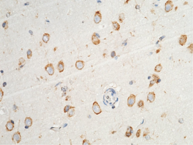 PDI Antibody in Immunohistochemistry (Paraffin) (IHC (P))