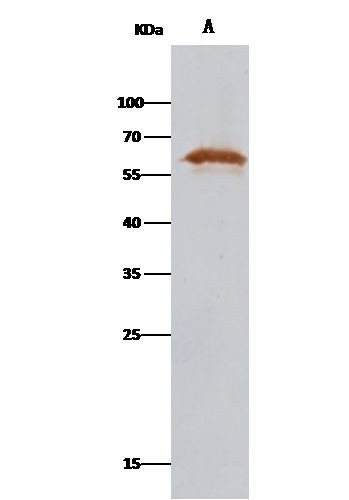 PDI Antibody in Immunoprecipitation (IP)