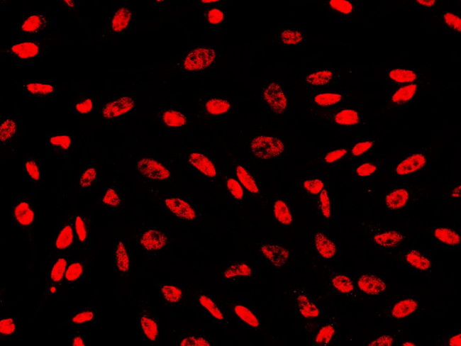 PAX8 Antibody in Immunocytochemistry (ICC/IF)