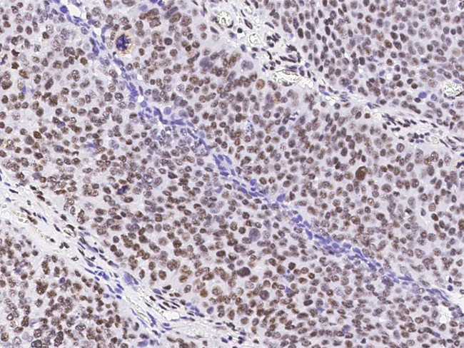 PAX8 Antibody in Immunohistochemistry (Paraffin) (IHC (P))