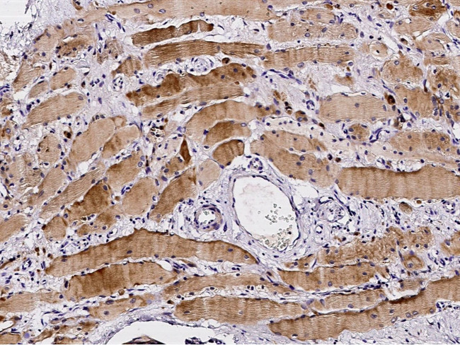 Profilin 2 Antibody in Immunohistochemistry (Paraffin) (IHC (P))