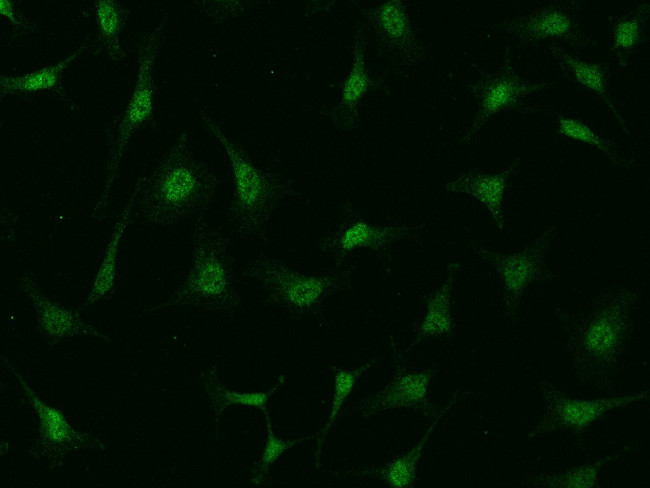 PIK3CB Antibody in Immunocytochemistry (ICC/IF)