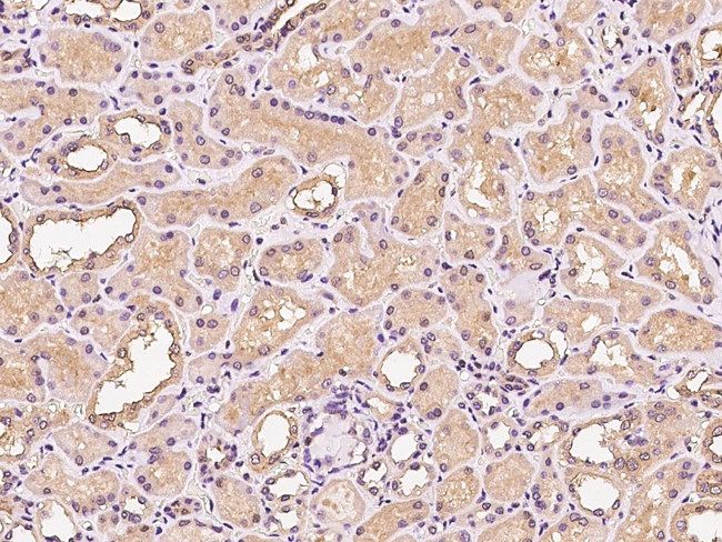 PIK3CB Antibody in Immunohistochemistry (Paraffin) (IHC (P))