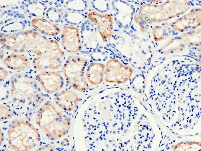 RBP4 Antibody in Immunohistochemistry (Paraffin) (IHC (P))