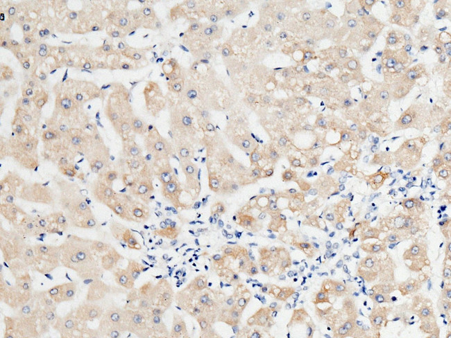 RBP4 Antibody in Immunohistochemistry (Paraffin) (IHC (P))