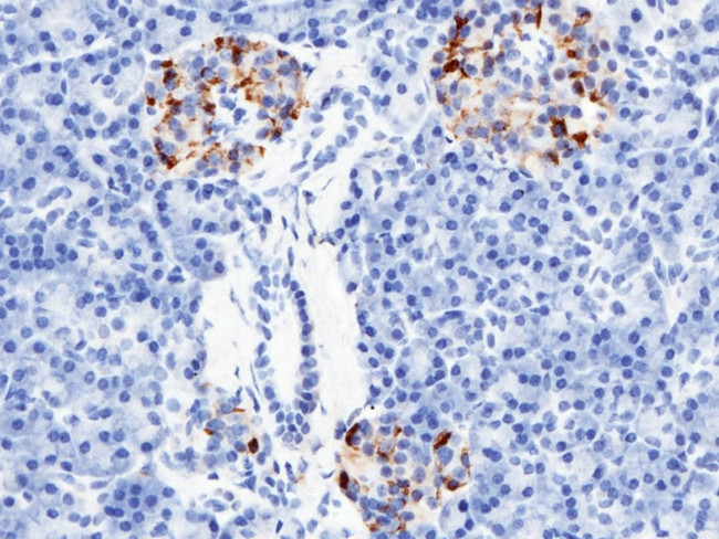 RBP4 Antibody in Immunohistochemistry (Paraffin) (IHC (P))