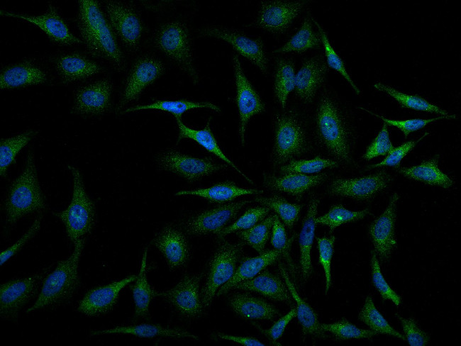 Periostin Antibody in Immunocytochemistry (ICC/IF)