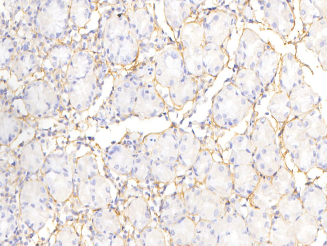 Periostin Antibody in Immunohistochemistry (Paraffin) (IHC (P))