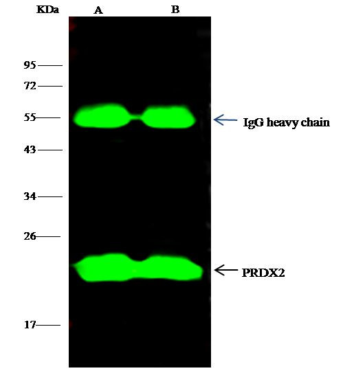PRDX2 Antibody in Immunoprecipitation (IP)