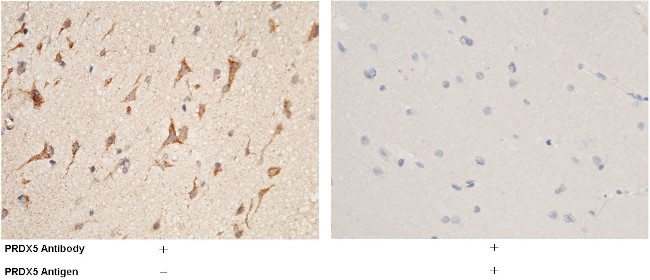 PRDX5 Antibody in Immunohistochemistry (Paraffin) (IHC (P))