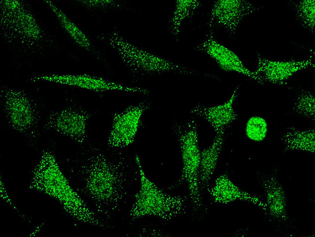 PKC delta Antibody in Immunocytochemistry (ICC/IF)