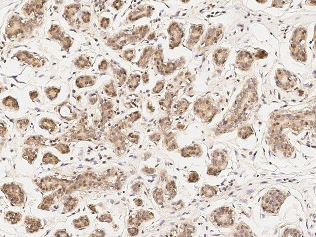 PKC delta Antibody in Immunohistochemistry (Paraffin) (IHC (P))