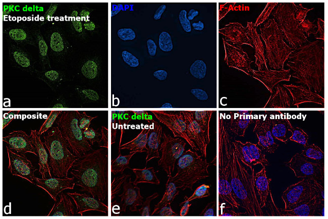 PKC delta Antibody