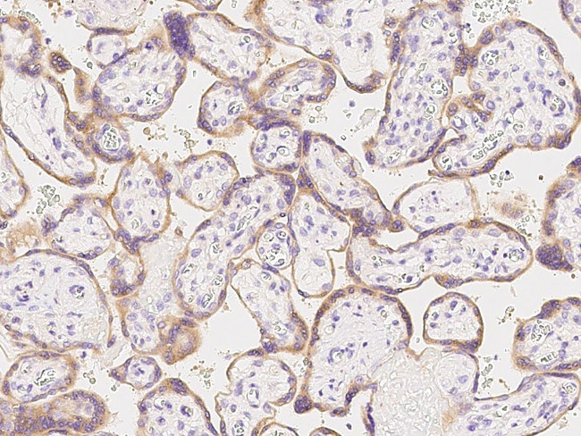 Prolactin Receptor Antibody in Immunohistochemistry (Paraffin) (IHC (P))