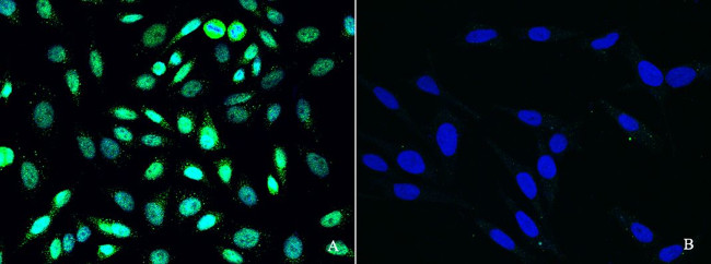 PRMT6 Antibody in Immunocytochemistry (ICC/IF)