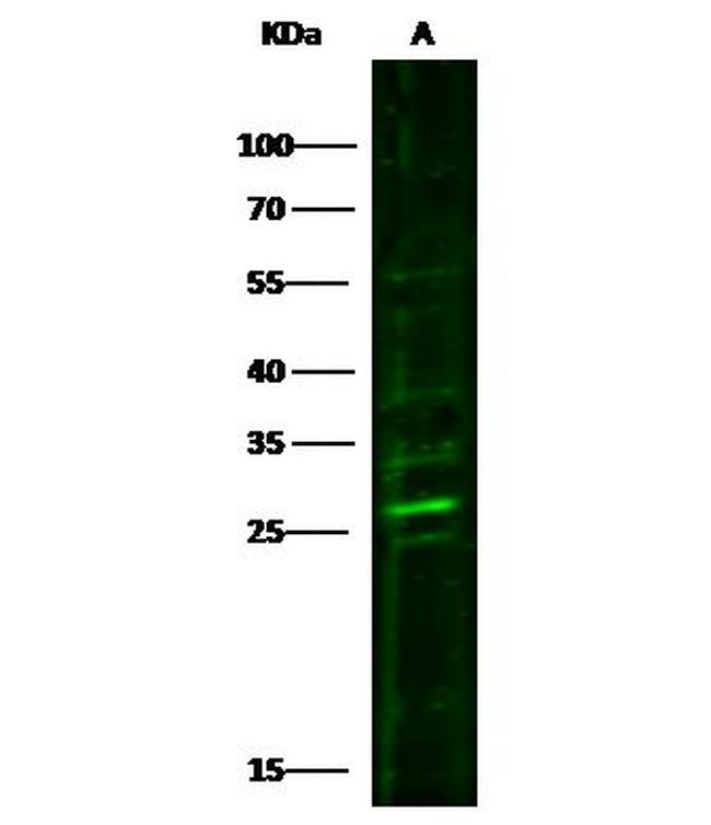 PRTFDC1 Antibody in Western Blot (WB)