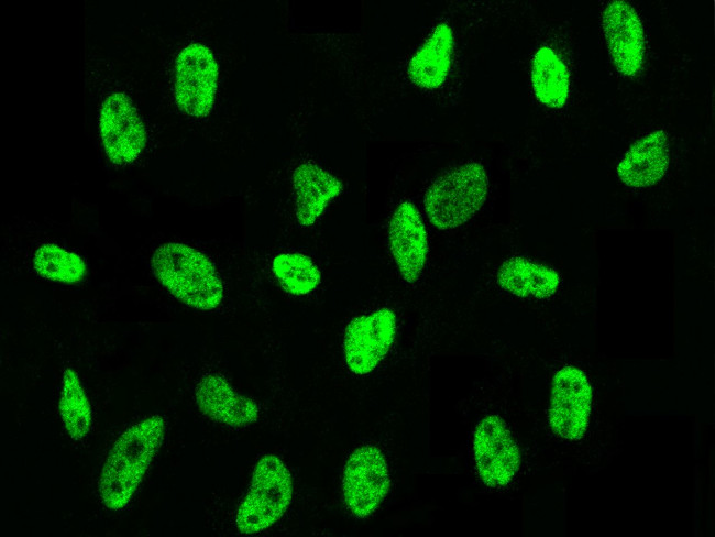 PSME3 Antibody in Immunocytochemistry (ICC/IF)