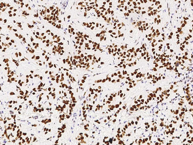 PSME3 Antibody in Immunohistochemistry (Paraffin) (IHC (P))