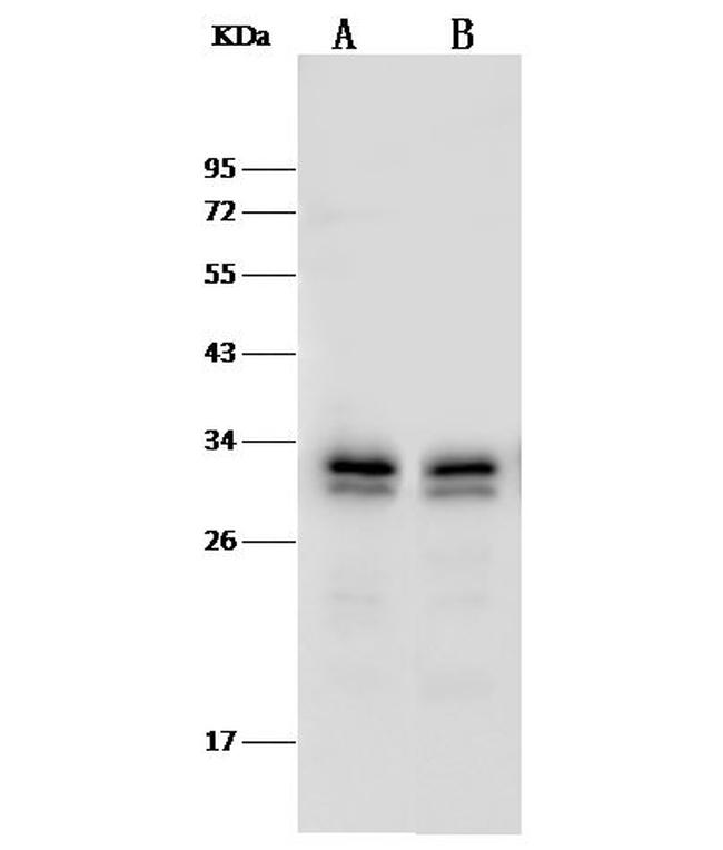 PSME3 Antibody in Western Blot (WB)