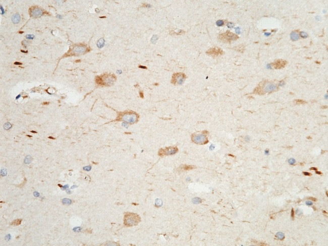 PTH1R Antibody in Immunohistochemistry (Paraffin) (IHC (P))