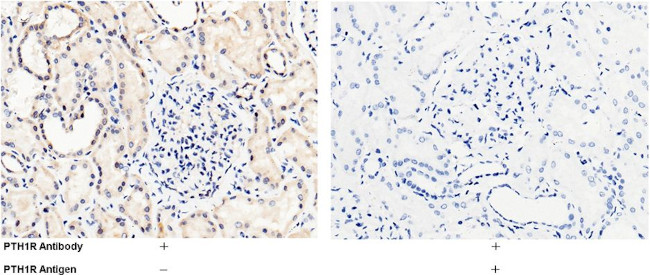 PTH1R Antibody in Immunohistochemistry (Paraffin) (IHC (P))