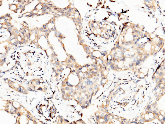 PTH1R Antibody in Immunohistochemistry (Paraffin) (IHC (P))